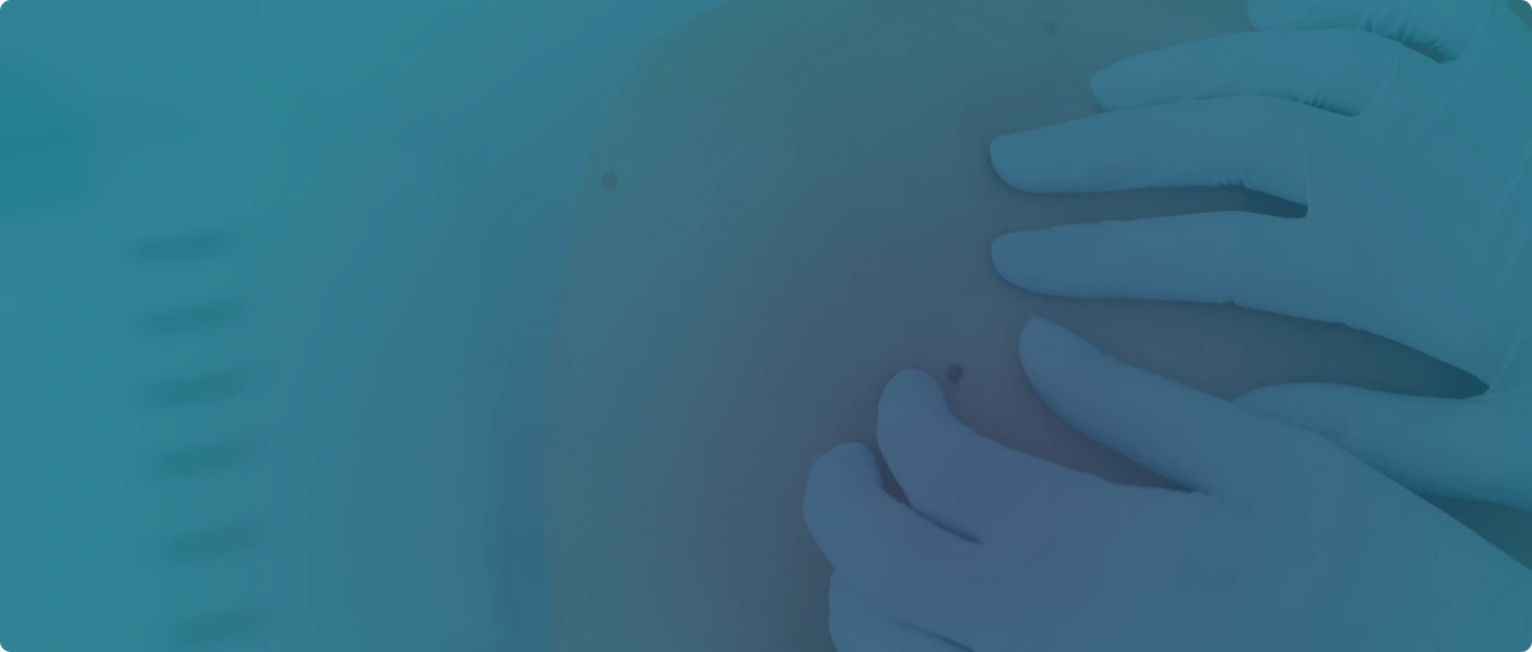 Procedure image