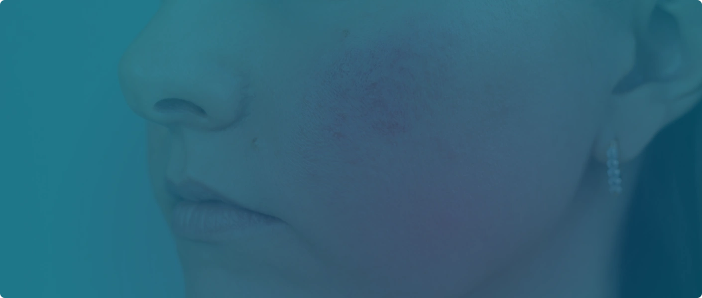 Procedure image