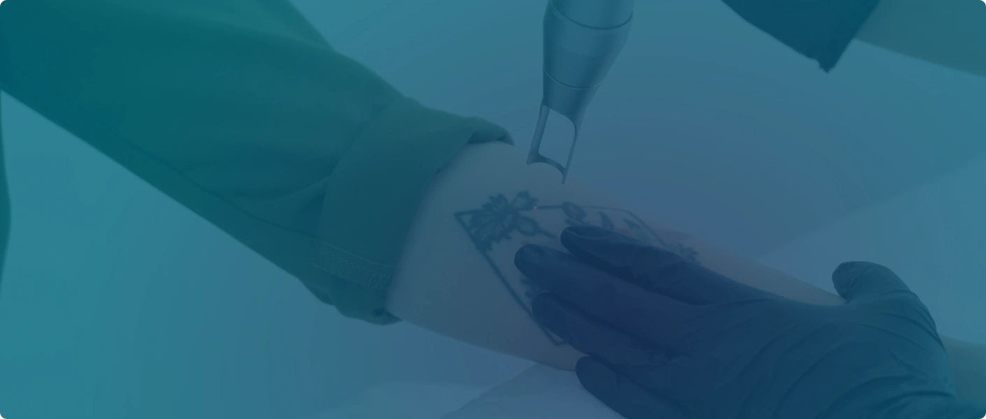 Procedure image