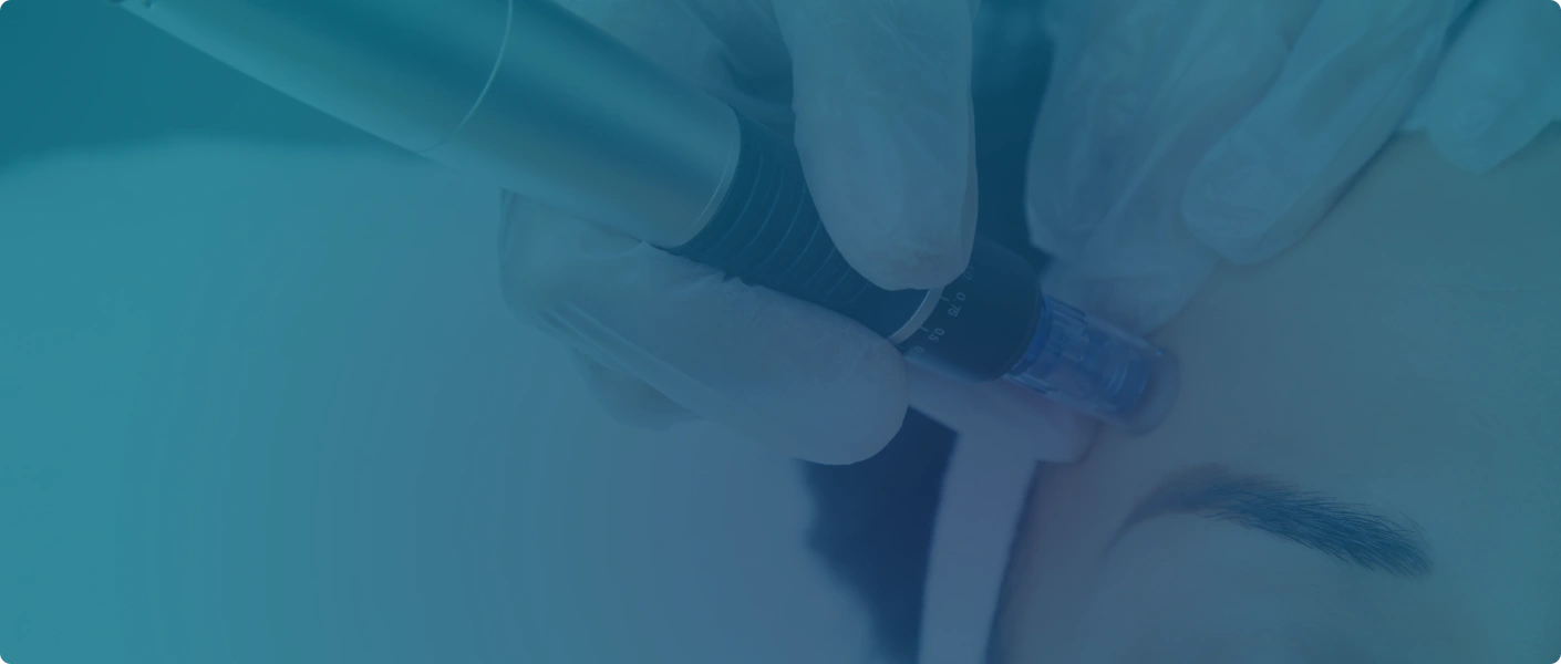 Procedure image